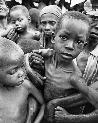 starving children in africa. those lively children of your